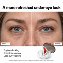 Sanilogica Reviva - Red Light Eye Patches with EMS & Charging Case